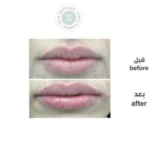 Dermatology Services in Abu Dhabi | Skin Clinic